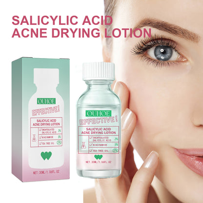 OUHOE Salicylic Acid Acne Lotion Gentle Repair Acne Skin Pore Refinement Facial Moisturizing Lotion