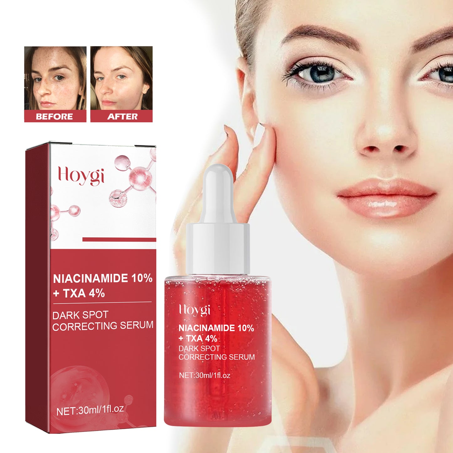 Hoygi Dark Spot Repair Serum Lightening Skin Dark Spots Age Spots Moisturizing Brightening Repair Essence